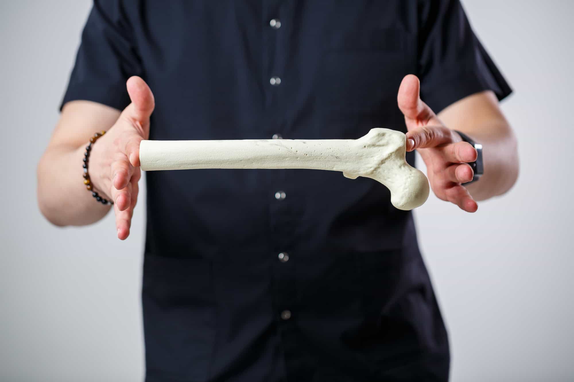 A person holding a human femur bone model, symbolising Ascleus's focus on bone health and regeneration.